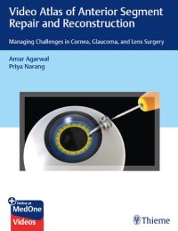 cover of the book Video Atlas of Anterior Segment Repair and  Reconstruction:  Managing Challenges in Cornea, Glaucoma, and Lens Surgery