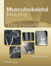 cover of the book Musculoskeletal Imaging: The Essentials