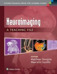 cover of the book Neuroimaging: A Teaching File: A Teaching File (LWW Teaching File Series)