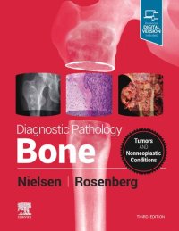 cover of the book Bone