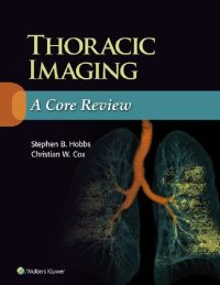 cover of the book Thoracic Radiology: A Core Review