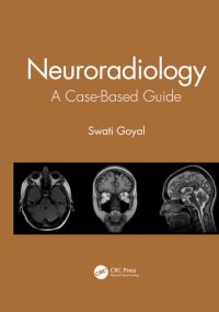 cover of the book Neuroradiology: A Case-Based Guide