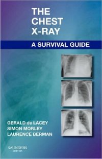 cover of the book The Chest X-Ray: A Survival Guide