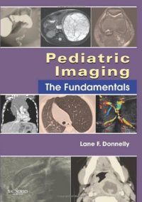 cover of the book Pediatric Imaging: The Fundamentals (Fundamentals of Radiology)