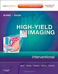 cover of the book High-Yield Imaging: Interventional: Expert Consult - Online and Print, 1e (HIGH YIELD in Radiology)