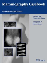 cover of the book Mammography Casebook: 100 Studies in Breast Imaging