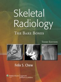 cover of the book Skeletal Radiology: The Bare Bones