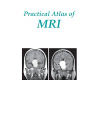 cover of the book Practical Atlas of MRI