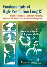 cover of the book Fundamentals of High-Resolution Lung CT: Common Findings, Common Patters, Common Diseases and Differential Diagnosis: Common Findings, Common Patterns, Common Diseases, and Differential Diagnosis