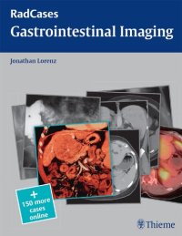 cover of the book Gastrointestinal Imaging (Radcases Plus Q&A)