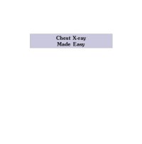 cover of the book Chest X-ray Made Easy