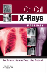 cover of the book On-Call X-Rays Made Easy