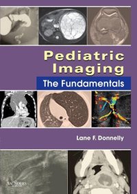 cover of the book Pediatric Imaging E-Book: The Fundamentals