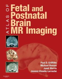 cover of the book Atlas of Fetal and Postnatal Brain MR