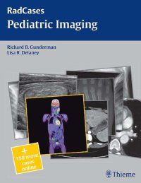 cover of the book Pediatric Imaging (RadCases)