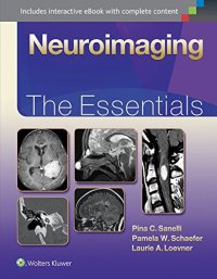 cover of the book Neuroimaging: The Essentials (Essentials Series)