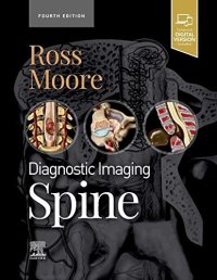 cover of the book Diagnostic Imaging: Spine