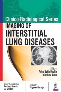 cover of the book Clinico Radiological Series:Imaging Of Interstitial Lung Diseases