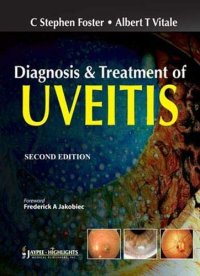 cover of the book Diagnosis and Treatment of Uveitis