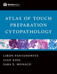 cover of the book Atlas of Touch Preparation Cytopathology by springer ,Liron Pantanowitz, MD / Juan Xing, MD / Sara E. Monaco, MD