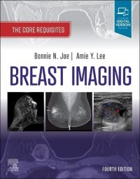 cover of the book Breast Imaging: The Core Requisites