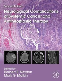 cover of the book Neurological Complications of Systemic Cancer and Antineoplastic Therapy 2e Herbert B. Newton (editor), Mark G. Malkin (editor)