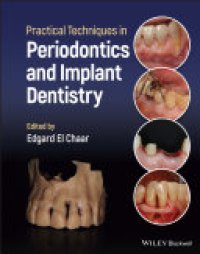 cover of the book Practical Techniques in Periodontics and Implant Dentistry