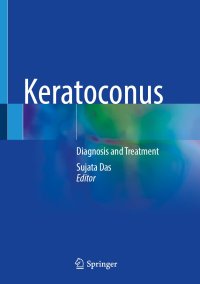 cover of the book Keratoconus: Diagnosis and Treatment