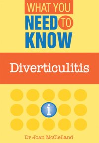 cover of the book Diverticulitis