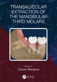 cover of the book Transalveolar Extraction of the Mandibular Third Molars