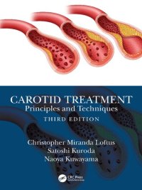 cover of the book Carotid Treatment: Principles and Techniques