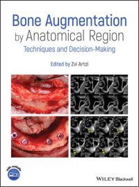 cover of the book Bone Augmentation by Anatomical Region: Techniques and Decision-Making