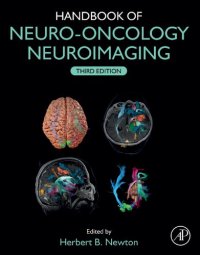 cover of the book Handbook of Neuro-Oncology Neuroimaging