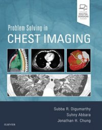 cover of the book Problem Solving in Chest Imaging (2019)