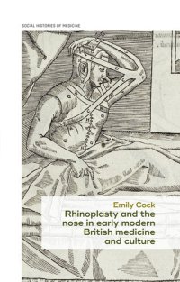 cover of the book Rhinoplasty and the nose in early modern British medicine and culture