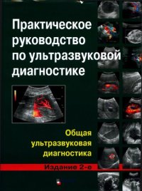 cover of the book Практическое руководство по ультразвуковой диагностике. Общая ультразвуковая диагностика