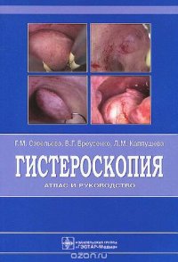 cover of the book Гистероскопия. Атлас и руководство