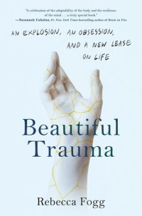 cover of the book Beautiful Trauma : An Explosion, an Obsession, and a New Lease on Life