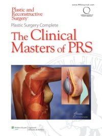 cover of the book Plastic Surgery Complete: The Clinical Masters of PRS: Breast Augmentation