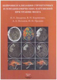 cover of the book Нейровизуализация структурных и гемодинамических нарушений при травме мозга