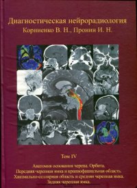 cover of the book Диагностическая нейрорадиология. Том IV. Анатомия основания черепа. Орбита. Передняя черепная ямка и краниофасциальная область. Хиазмально-селлярная область и средняя черепная ямка. Задняя черепная ямка