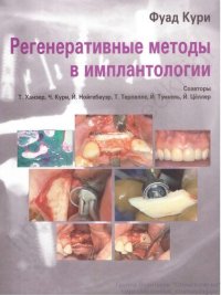 cover of the book Регенеративные методы в имплантологии