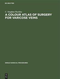 cover of the book A Colour Atlas of Surgery for Varicose Veins