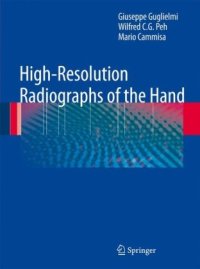 cover of the book High-Resolution Radiographs of the Hand