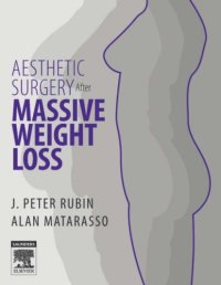 cover of the book Aesthetic Surgery After Massive Weight Loss