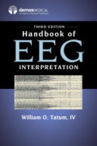 cover of the book Handbook of EEG Interpretation