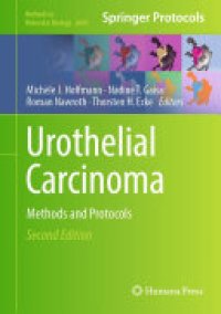 cover of the book Urothelial Carcinoma: Methods and Protocols