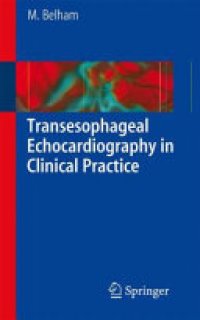 cover of the book Transesophageal Echocardiography in Clinical Practice