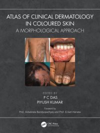 cover of the book Atlas of Clinical Dermatology in Coloured Skin