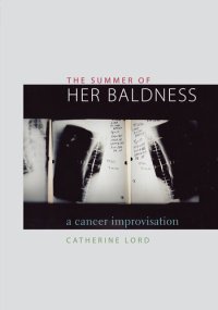 cover of the book The Summer of Her Baldness: a Cancer Improvisation